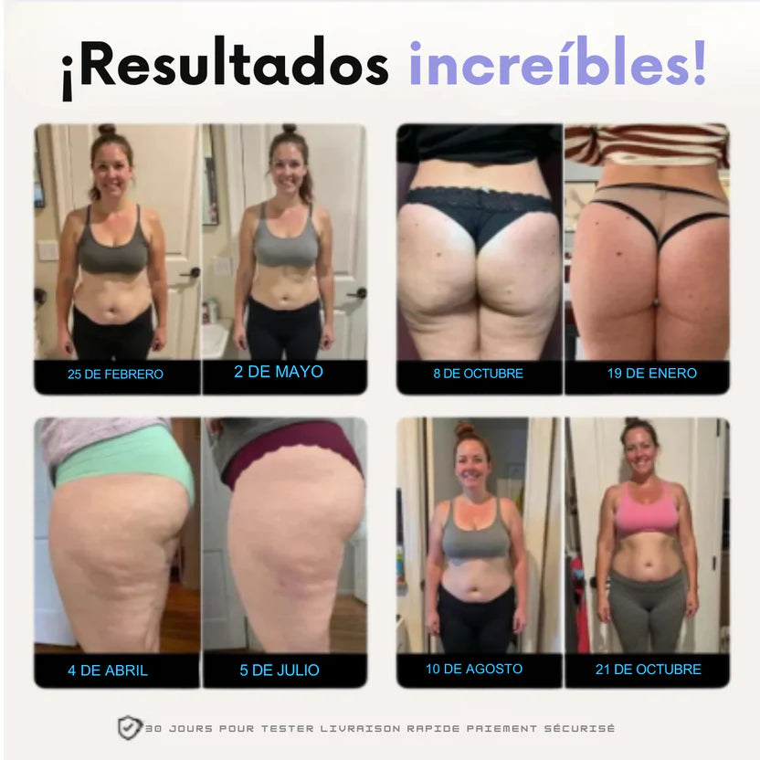 🔥Legging 3D que moldean y reducen celulitis
