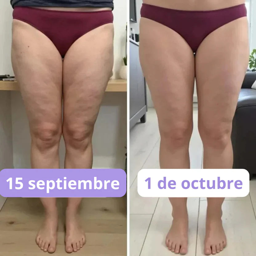 🔥Legging 3D que moldean y reducen celulitis